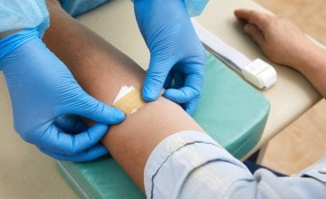 Lipoprotein (a) i kolesterol