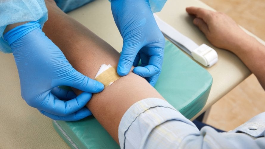 Lipoprotein (a) i kolesterol