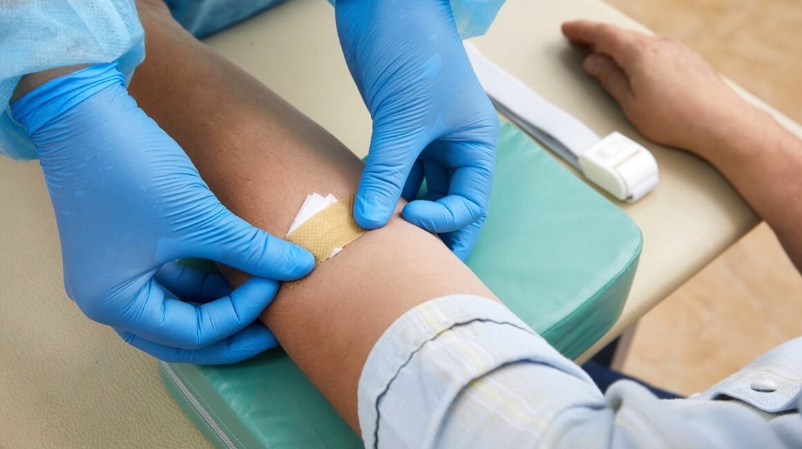 Lipoprotein (a) i kolesterol