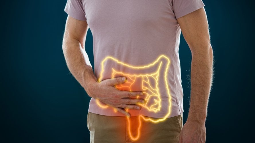 Redovita tjelesna aktivnost povezana je s čak 40 posto manjim rizikom od razvoja raka debelog crijeva