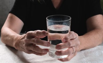 Reumatoidni artritis je kronična autoimuna bolest kod koje imunološki sustav napada vlastite zglobove, uzrokujući upalu, bol i ukočenost