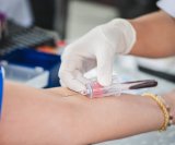 Rutinski krvni test jedan je od najjednostavnijih i najučinkovitijih načina za rano otkrivanje potencijalnih zdravstvenih problema