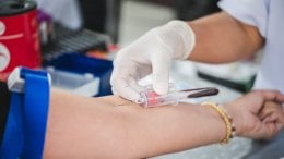 Rutinski krvni test jedan je od najjednostavnijih i najučinkovitijih načina za rano otkrivanje potencijalnih zdravstvenih problema