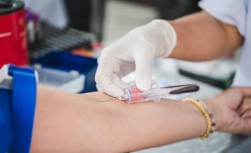 Rutinski krvni test jedan je od najjednostavnijih i najučinkovitijih načina za rano otkrivanje potencijalnih zdravstvenih problema