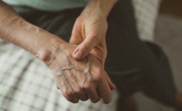 Stres je poznati okidač pogoršanja reumatoidnog artritisa