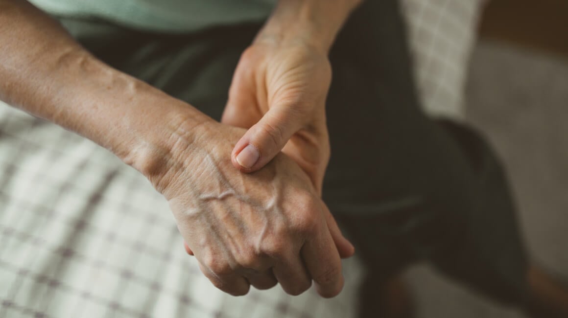 Stres je poznati okidač pogoršanja reumatoidnog artritisa