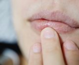 Suha usta mogu biti mnogo više od neugodne tegobe - često su znak da vašem tijelu nešto nedostaje