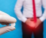 Tablete za prostatu na recept