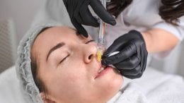 Uklanjanje filera iz usana