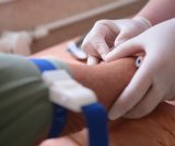 Viša razina troponina povezana s 38 posto većim rizikom od demencije