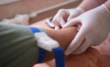 Viša razina troponina povezana s 38 posto većim rizikom od demencije