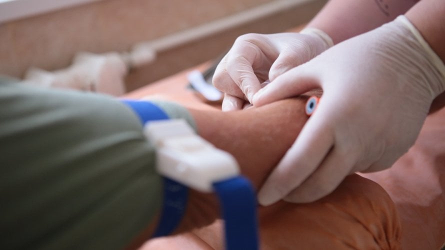 Viša razina troponina povezana s 38 posto većim rizikom od demencije