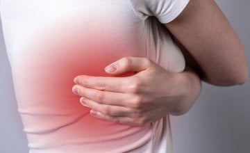 interkostalna neuralgija