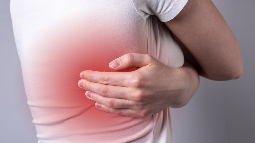 interkostalna neuralgija