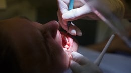 liječenje korijenskog kanala može poboljšati razinu šećera u krvi, kolesterol i smanjiti upalne procese u tijelu