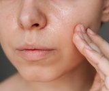 masna koža stari drugačije od ostalih tipova kože, ali to ne znači nužno i manje bora - već drugačije vrste bora