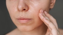 masna koža stari drugačije od ostalih tipova kože, ali to ne znači nužno i manje bora - već drugačije vrste bora