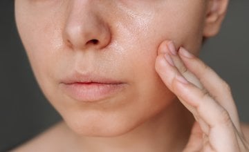 masna koža stari drugačije od ostalih tipova kože, ali to ne znači nužno i manje bora - već drugačije vrste bora