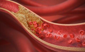 nezdrava veganska prehrana može povećati razinu kolesterola u krvi