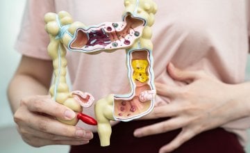 praćenje bakterija u crijevima i njihovih metabolita moglo bi pomoći u prepoznavanju rizika za razvoj koronarne bolesti srca