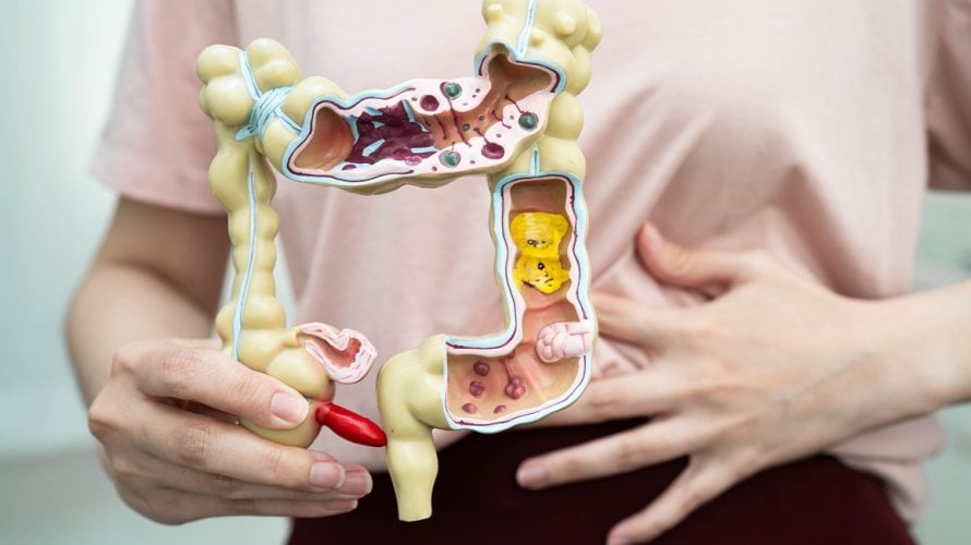 praćenje bakterija u crijevima i njihovih metabolita moglo bi pomoći u prepoznavanju rizika za razvoj koronarne bolesti srca