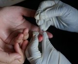 vađenje krvi iz prsta