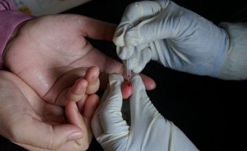 vađenje krvi iz prsta