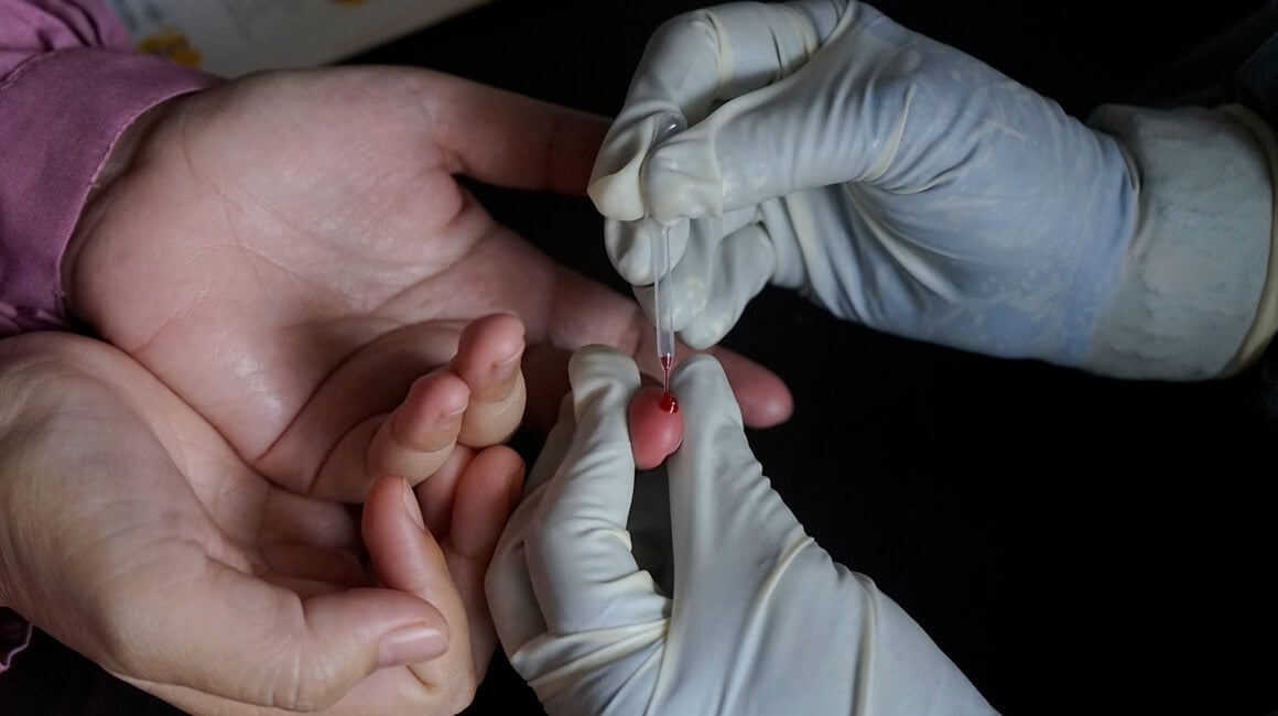 vađenje krvi iz prsta