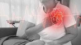 Fibrilacija atrija (AFib) jedan je od najčešćih poremećaja srčanog ritma