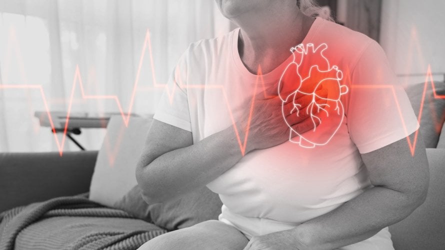 Fibrilacija atrija (AFib) jedan je od najčešćih poremećaja srčanog ritma