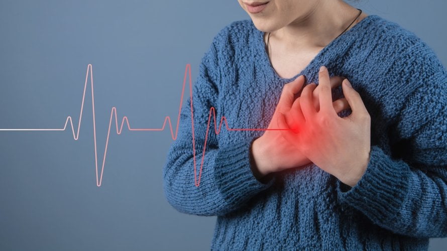 Jedan od najčešćih simptoma srčanog udara je aritmija