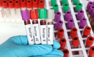 Kako saznati krvnu grupu