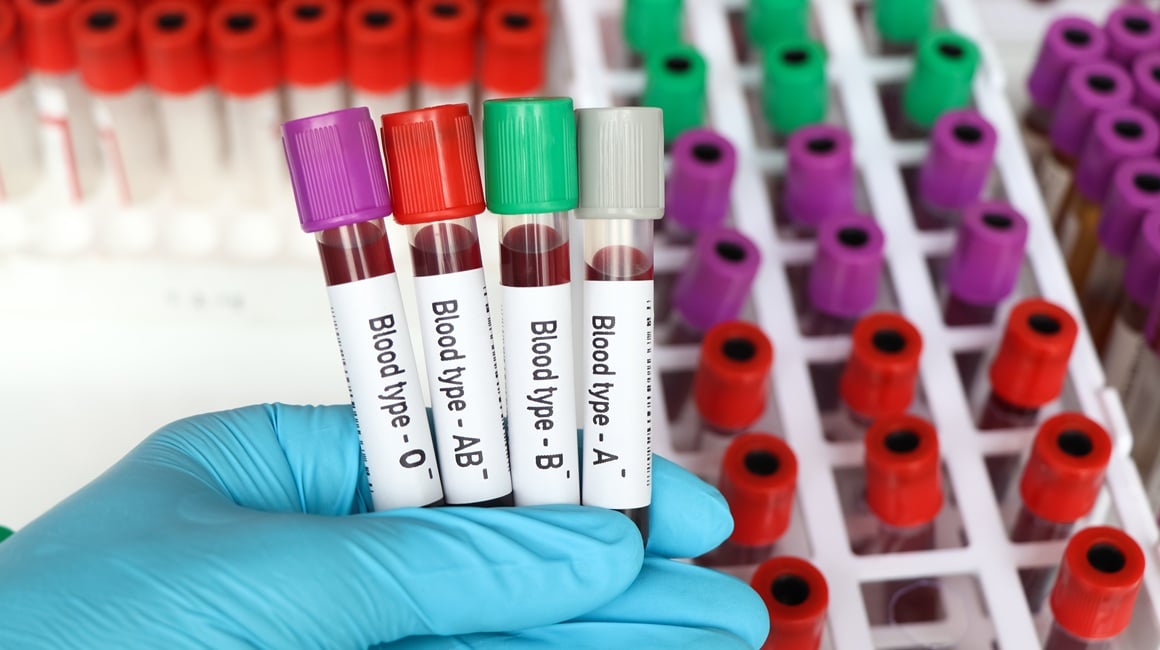 Kako saznati krvnu grupu