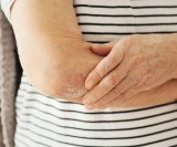 Kod psorijaze koža se obnavlja mnogo brže nego što bi trebala, što dovodi do nakupljanja srebrnih ili sivih ljuskica na upaljenim područjima