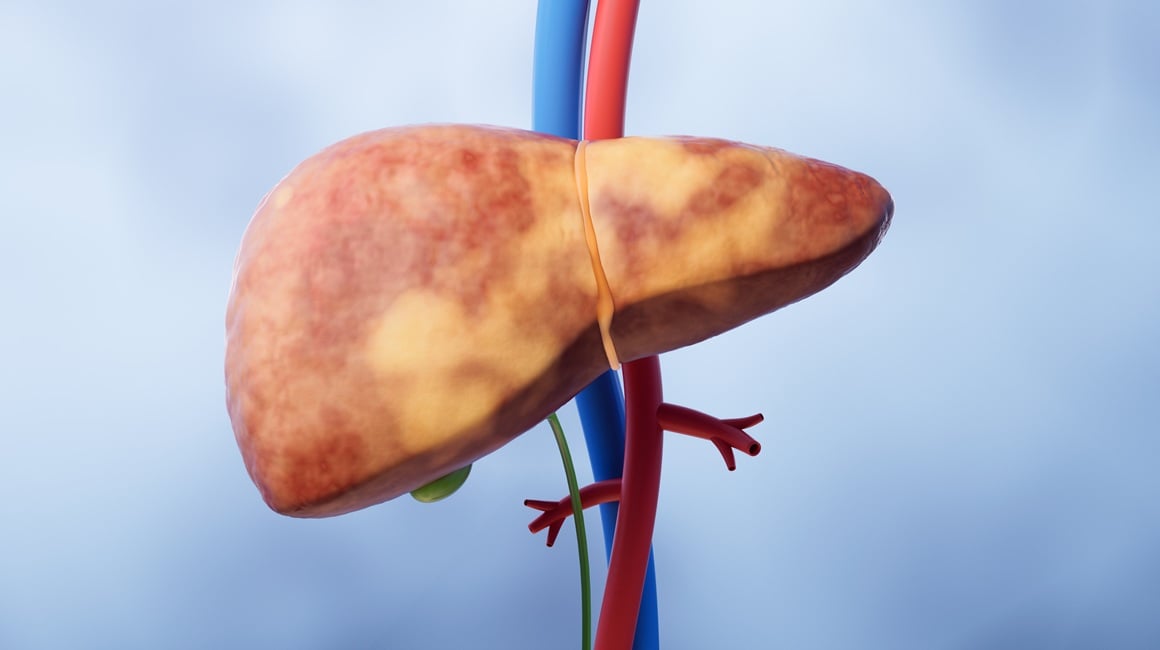 Mislite da imate samo masnu jetru Evo zašto biste trebali provjeriti i srce