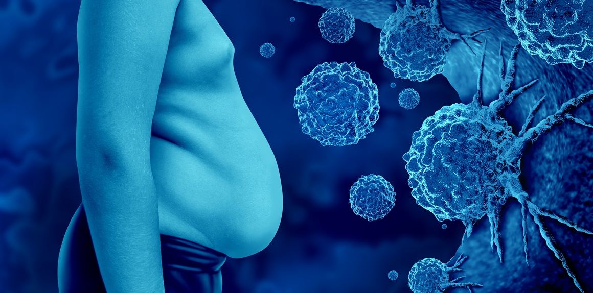 Mogu li GLP-1 lijekovi ipak štititi od raka