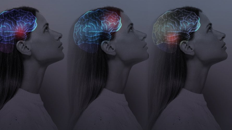 Mozak se ne razvija linearno - nego u skokovima