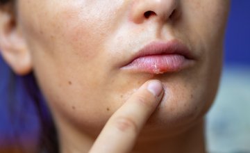 Pad imuniteta - simptomi kod odraslih