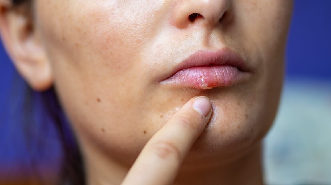 Pad imuniteta - simptomi kod odraslih