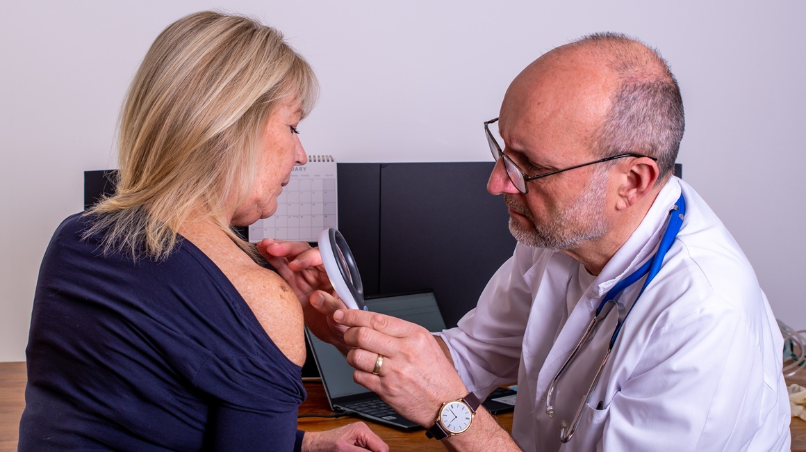 Rak kože jedan je od najčešćih oblika raka, a ujedno i jedan od onih koje je u velikoj mjeri moguće spriječiti