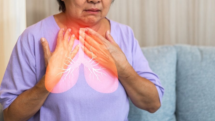 Rak pluća - simptomi kod žena