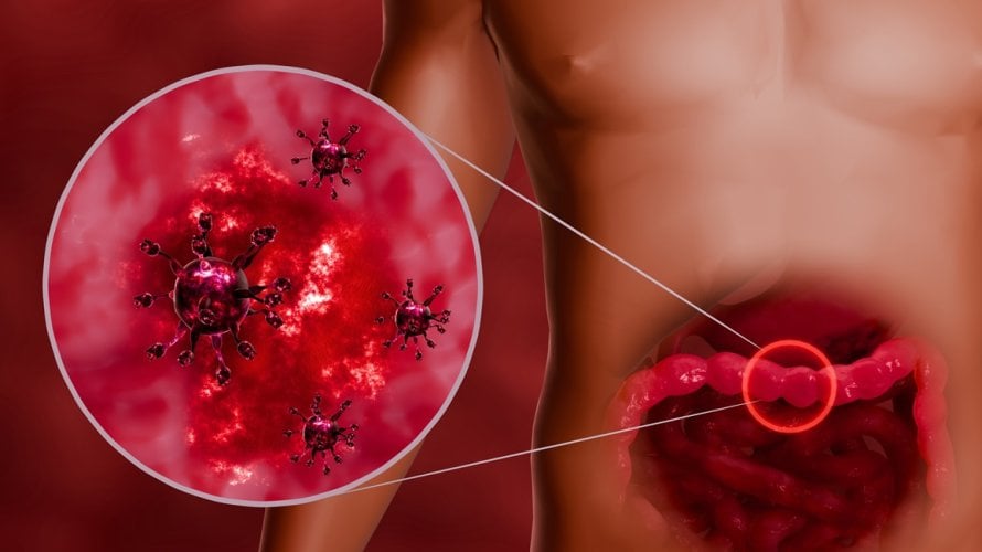 Sezona blagdana tek je počela, a norovirus - čest uzročnik naglog povraćanja i proljeva - već pokazuje neobično rani porast