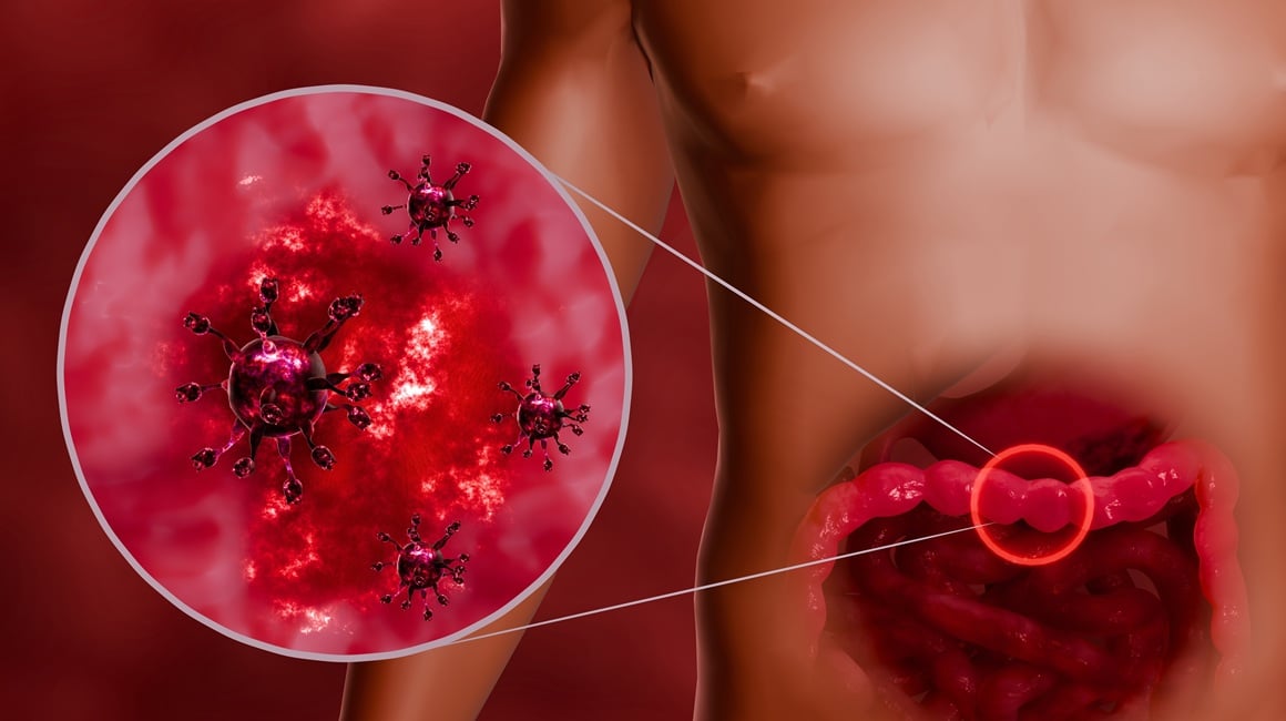 Sezona blagdana tek je počela, a norovirus - čest uzročnik naglog povraćanja i proljeva - već pokazuje neobično rani porast