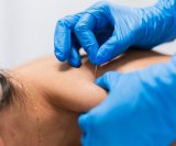 Sve više istraživanja sugerira da bi akupunktura mogla imati povoljan učinak na rad gušterače i regulaciju inzulina