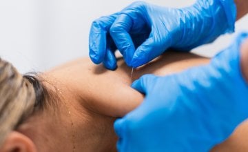 Sve više istraživanja sugerira da bi akupunktura mogla imati povoljan učinak na rad gušterače i regulaciju inzulina