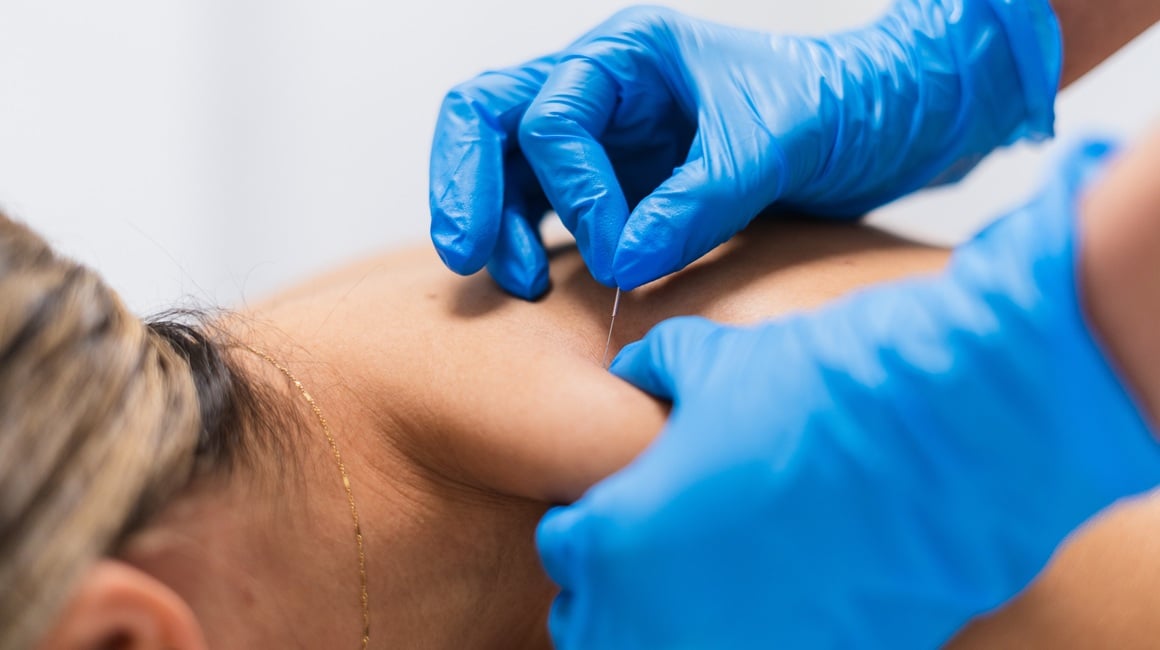 Sve više istraživanja sugerira da bi akupunktura mogla imati povoljan učinak na rad gušterače i regulaciju inzulina