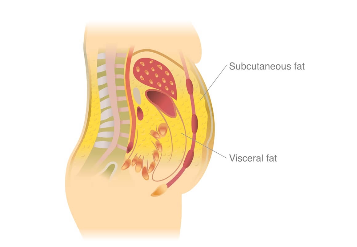 Visceralna mast posebno je štetna jer povećava rizik od metaboličkih bolesti i prerane smrti