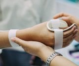 reumatoidni artritis