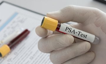 Ako nakon operacije ili zračenja raka prostate primijetite porast PSA vrijednosti, niste jedini - s tim se problemom suoči i do trećine muškaraca