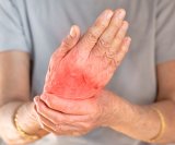 Ako živite s reumatoidnim artritisom, bol, ukočenost i oticanje šaka mogu pretvoriti i najjednostavnije kućanske zadatke u pravi izazov